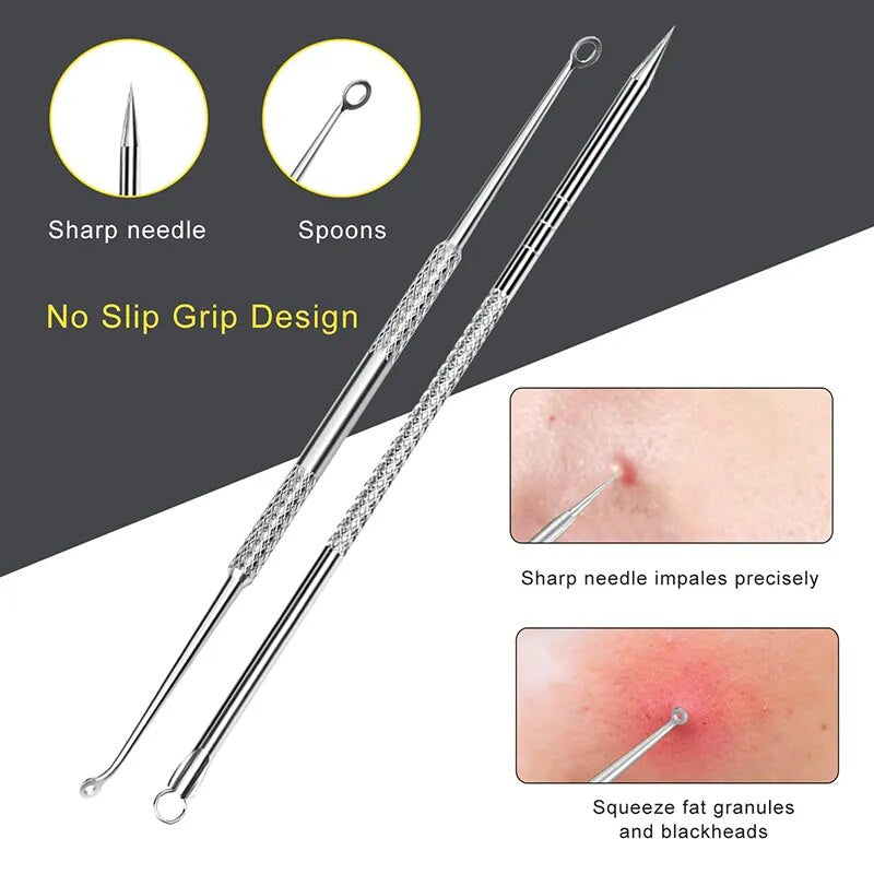 Blackhead Remover Tool10 Pcs Professional Pimple Comedone Extractor Tool Acne Removal Kit - Treatment for Pimples, Blackheads, Z
